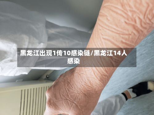 黑龙江出现1传10感染链/黑龙江14人感染