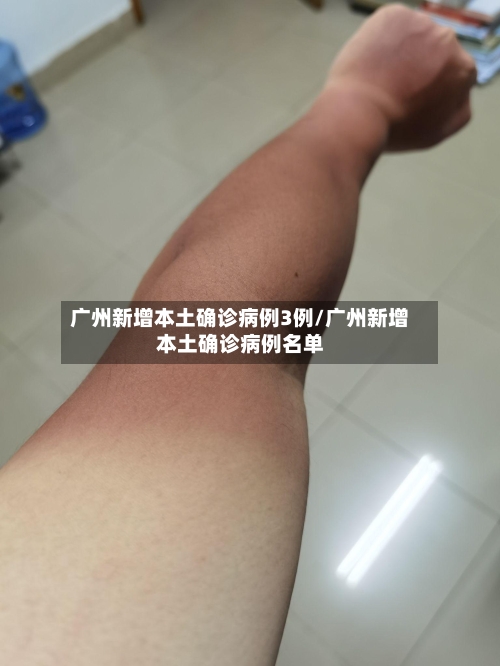广州新增本土确诊病例3例/广州新增本土确诊病例名单-第2张图片